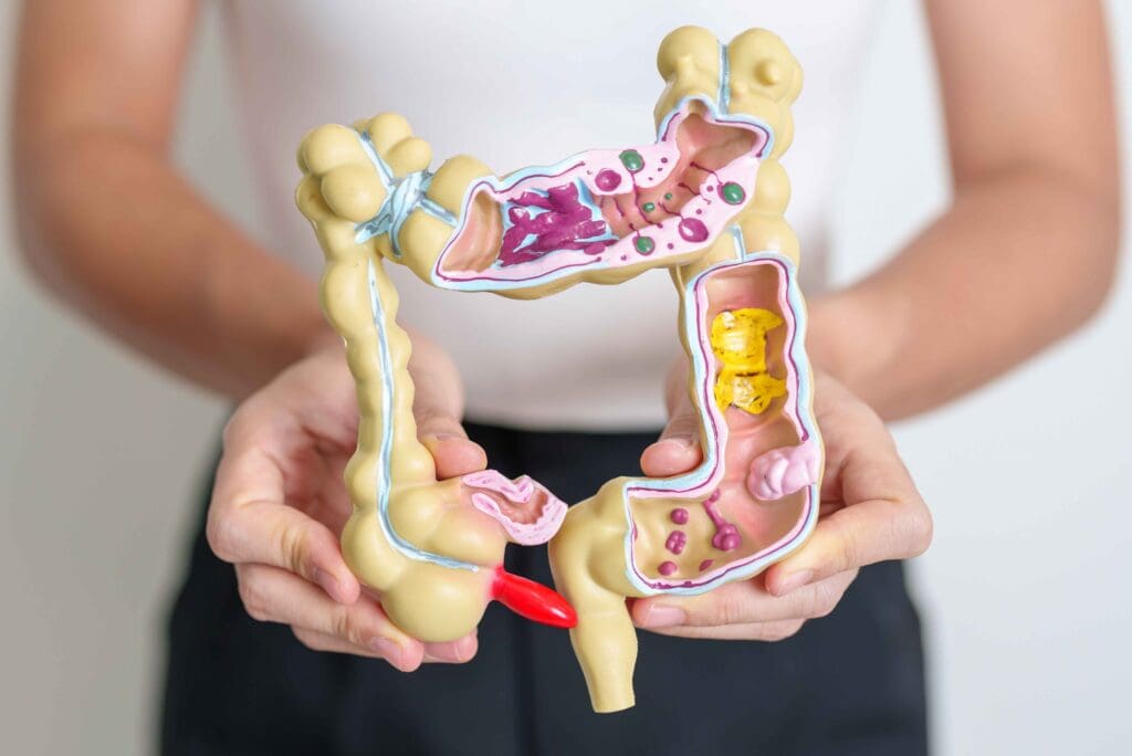 Modell vom Darm, Symbolbild, von Panuwat Dangsungnoen von Getty Images